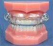 A range of dental appliances are available