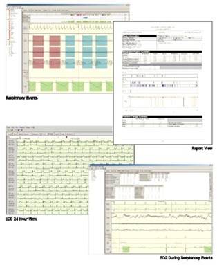 Data from the recorders is downloaded and interpreted by specialist independent sleep physicians