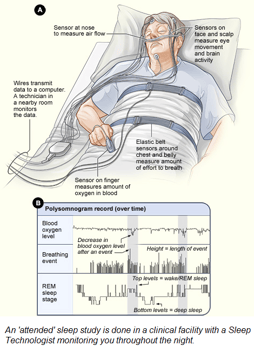 Sleep Study with caption